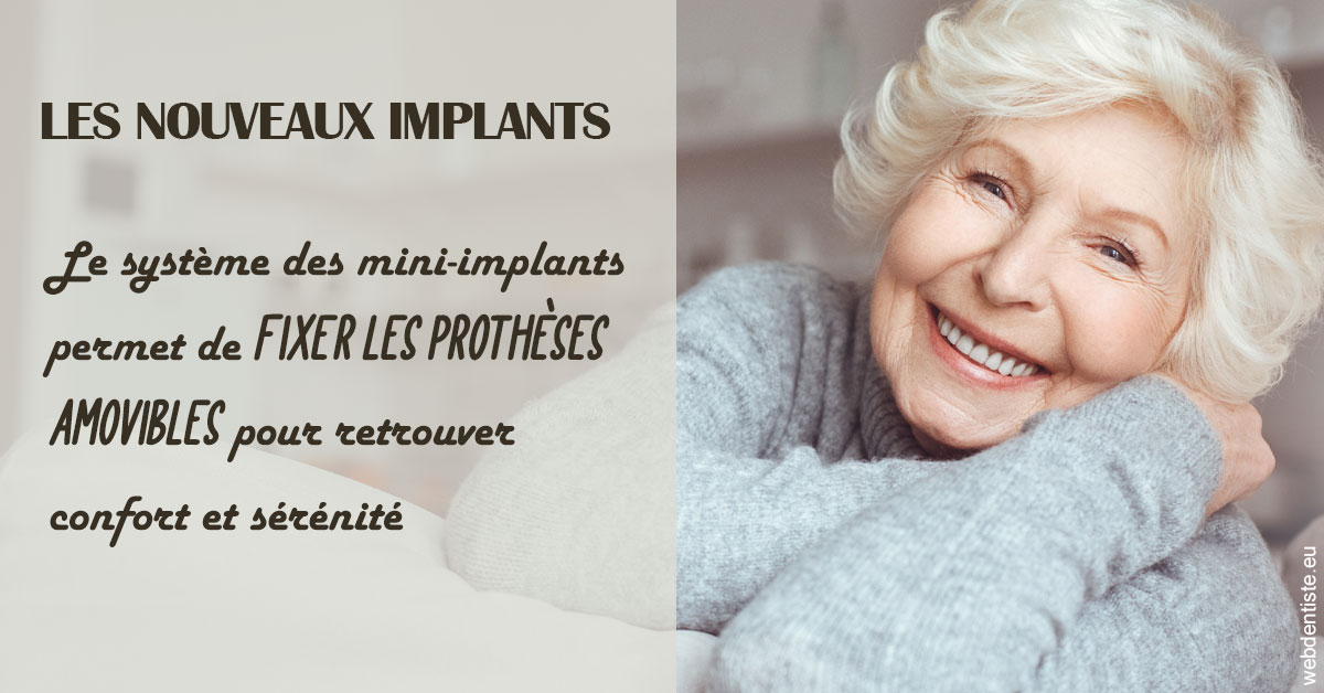 https://dr-charreyron-john.chirurgiens-dentistes.fr/Les nouveaux implants 1