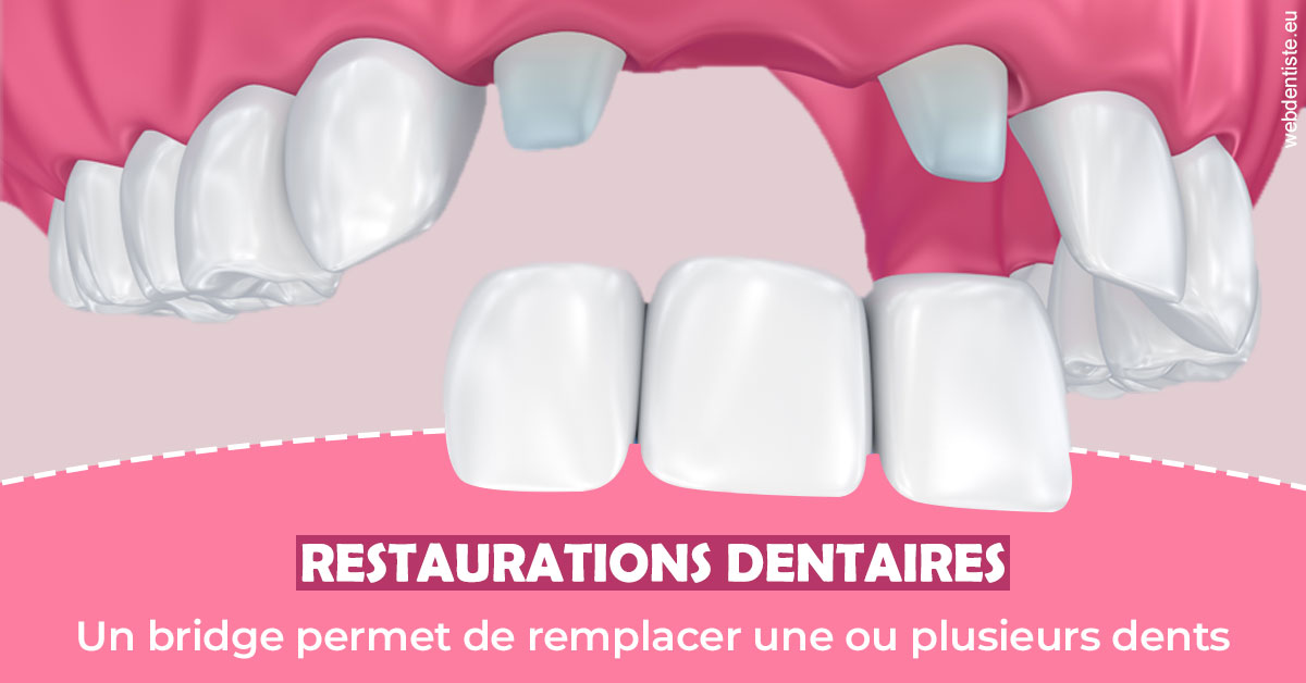 https://dr-charreyron-john.chirurgiens-dentistes.fr/Bridge remplacer dents 2