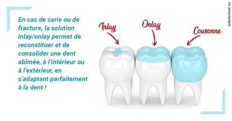https://dr-charreyron-john.chirurgiens-dentistes.fr/L'INLAY ou l'ONLAY