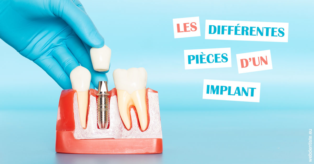 https://dr-charreyron-john.chirurgiens-dentistes.fr/Les différentes pièces d’un implant 2
