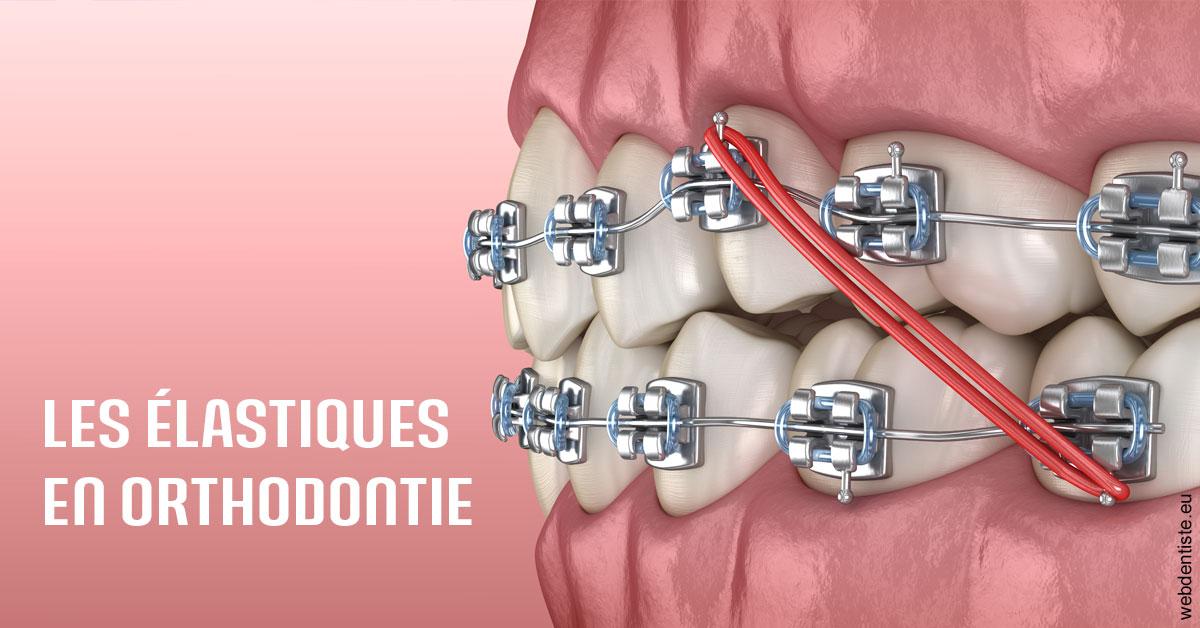 https://dr-charreyron-john.chirurgiens-dentistes.fr/Elastiques orthodontie 2