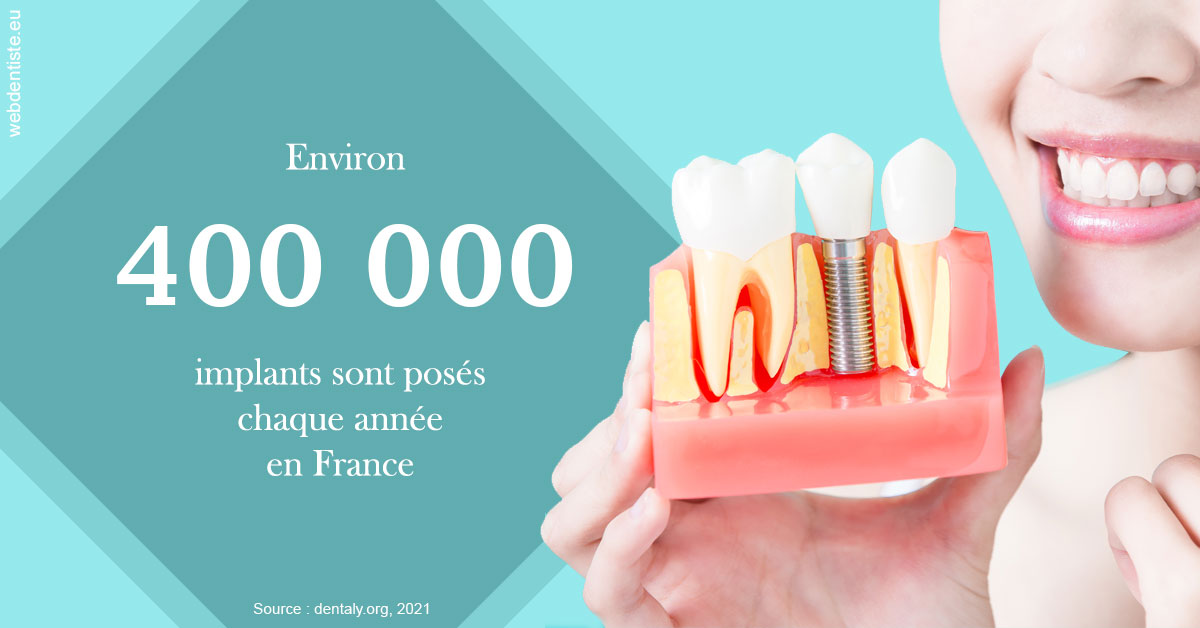 https://dr-charreyron-john.chirurgiens-dentistes.fr/Pose d'implants en France 2